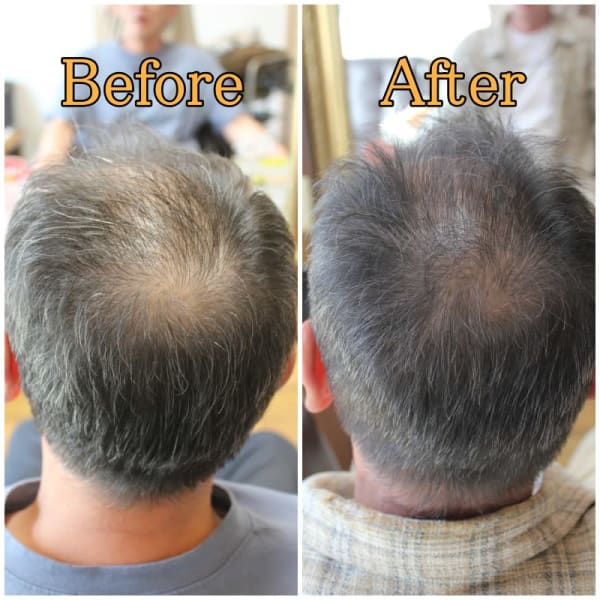 病院の育毛ケアが美容院できます！メディカル育毛|くせ毛専門美容室ヘアエステ ウィルミナ