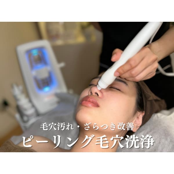 【毛穴洗浄】毛穴汚れ・ざらつき・角栓・ニキビケア!潤いのあるツヤ肌に★|salon83