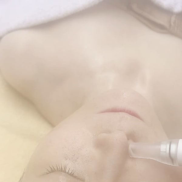 古いお肌を脱ぎ捨てることからハリ・ツヤ・血色の良いお肌に!揺らぎ肌ケア&毛穴・角質ケアしませんか?|セラピールーム アンシャンテ