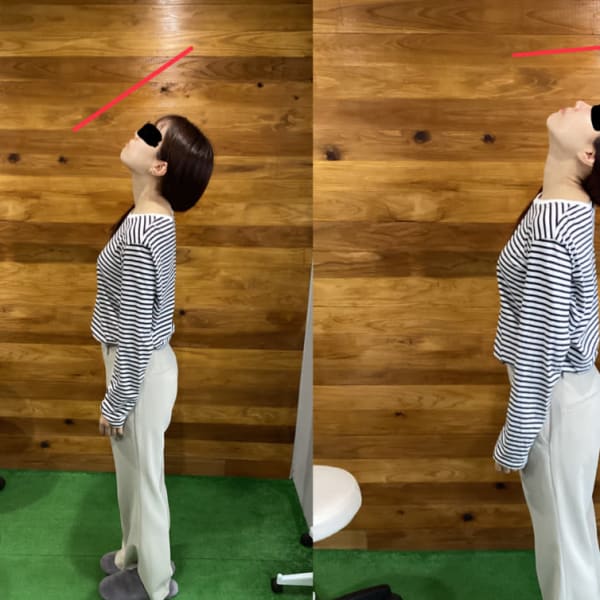 上を向けない首を改善しました!|首専門 ちめぐり整体院