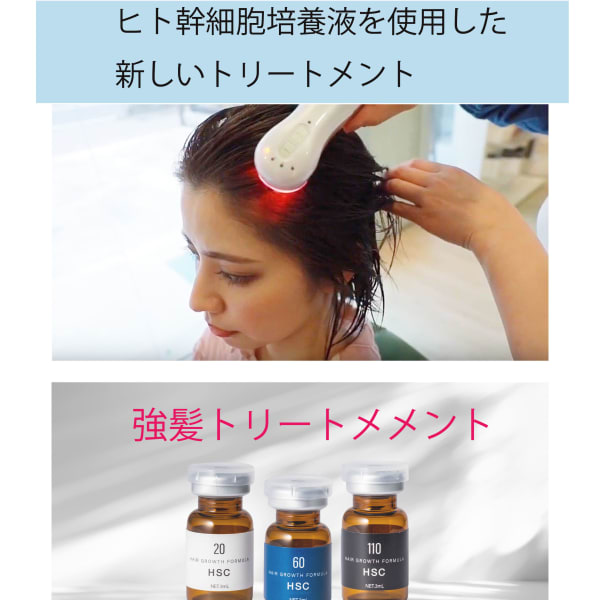 ヒト幹細胞培養液を使用した地肌のトリートメント|blue-eyed girl