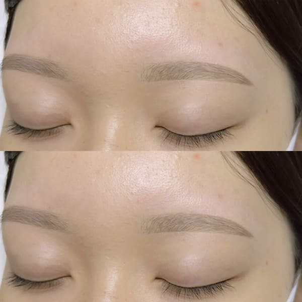 化粧ノリUP◎眉毛・フェイス脱毛で透明感溢れる印象に♪モデル・芸能人も通い続ける人気眉毛サロン！|アイブロウ眉毛サロン Mond 新宿三丁目店【まゆげ専門店】