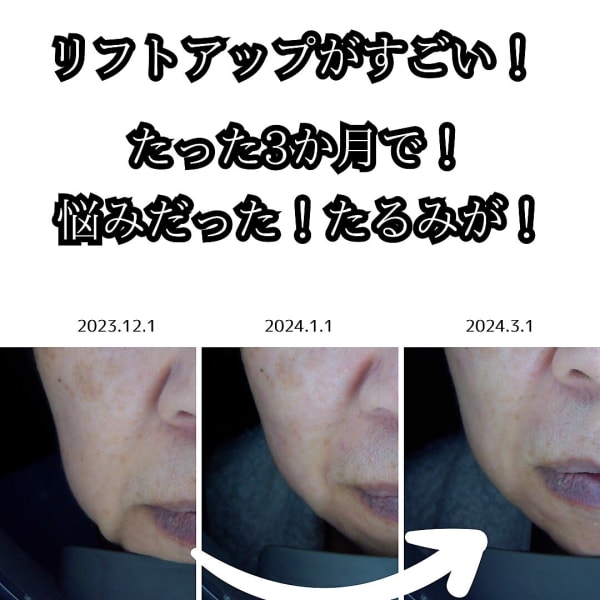 人気！毛穴集中コース（90分）￥22,000→￥11,000初回のみ|ファビュラス・リゾート