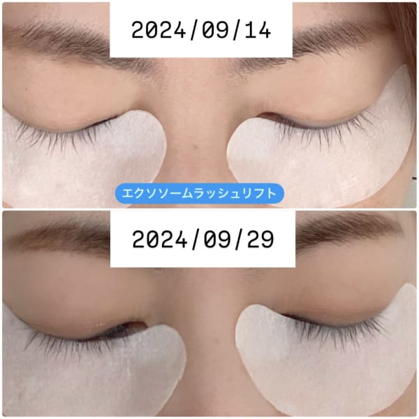 スタッフの自まつ毛も育っています(^^)|uchiny