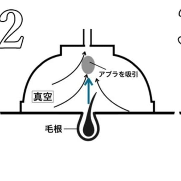 真空含浸法とは|メンズ縮毛矯正専門店scintiller鹿児島中央駅店