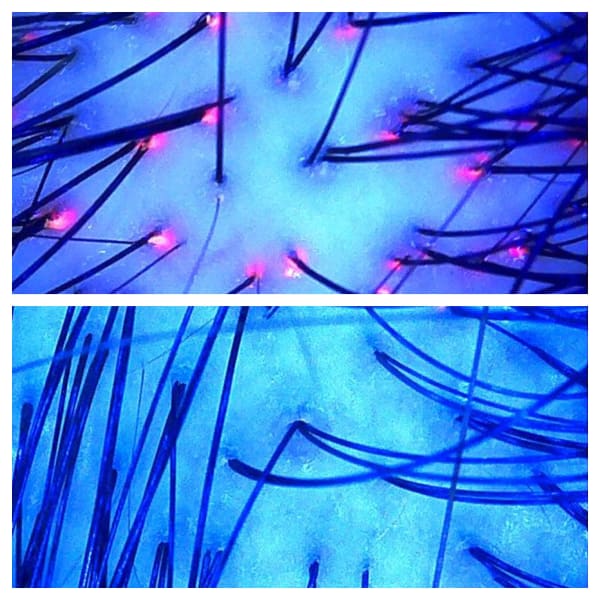 頭皮の酸化臭はお身体の酸化のSOSサインです。しっかり洗えているのに気になるなら今すぐ頭皮チェック!|Miel et Fleurs