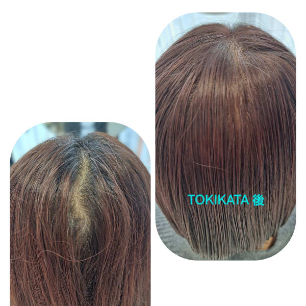 TOKIKATA（トキカタ）頭頂部編|Hair & Spa y‐Forme Ginza