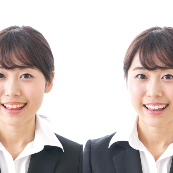 全国60店舗・累計来店者数10万人超の人気ホワイトニングサロン|プラチナムビューティー名古屋栄店