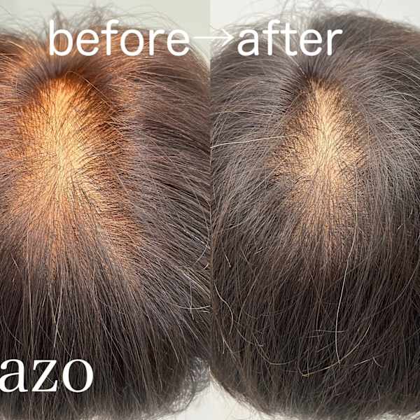 ぺたんこ・ひろがり・パサつき髪のお悩み解決サロン|増毛エクステ/ウィッグ専門店 Lazo hair【ラソヘアー】