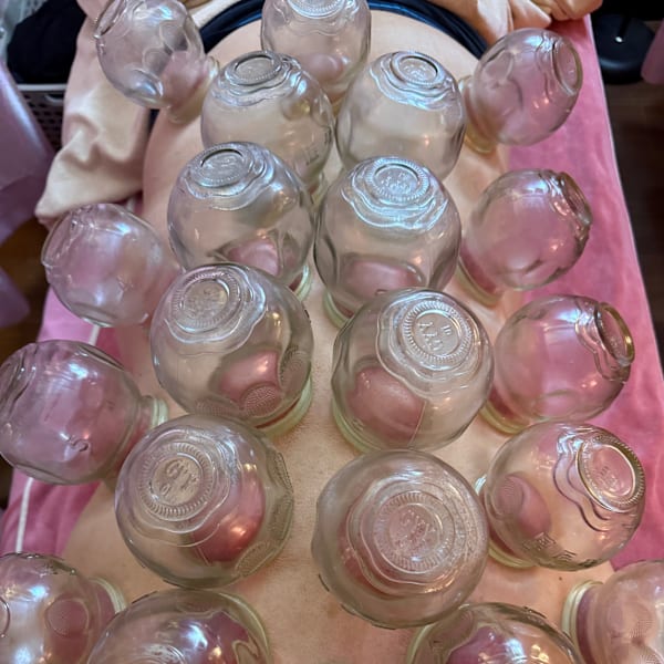 大人気なカッピング|四季縁 栄店~もみほぐし・足ツボ ・アロマリンパオイル専門店