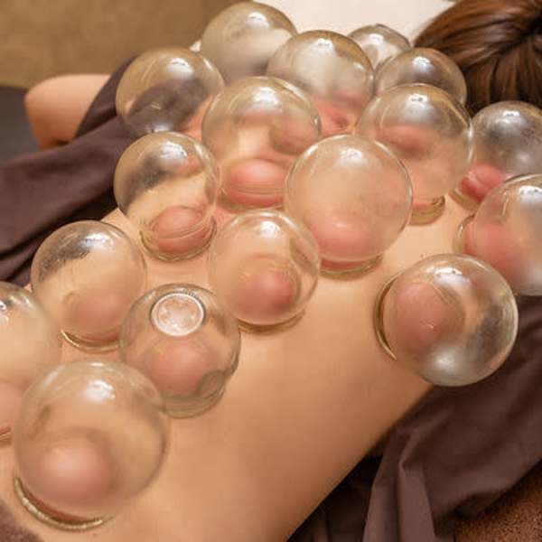 こんな方に吸い玉（カッピング）をぜひおススメ|肩こり腰痛整体院 溝の口