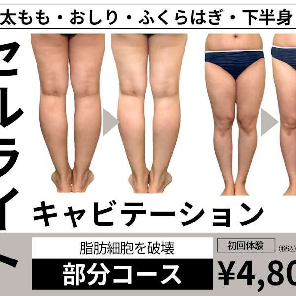 【ガチガチ脂肪燃焼・下半身に】膜を破壊!キャビテーション部分コース¥4800|CHARiS BEAUTE 関本店