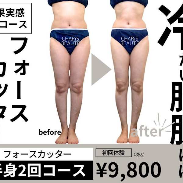 【全身じゃなく半身痩せたい】贅肉が冷たい方は絶対これ！上/下半身2回コース|CHARiS BEAUTE 関本店