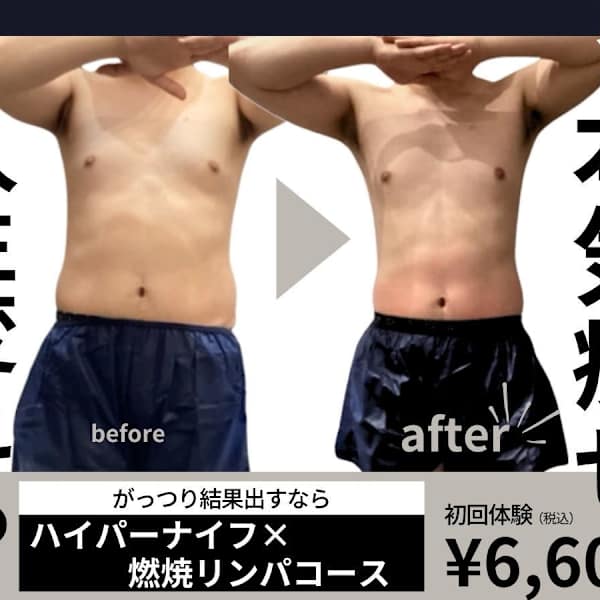 【効果◎痩せるしかない贅沢セット】ハイパーナイフ×燃焼リンパコース¥6600|メンズボーテU