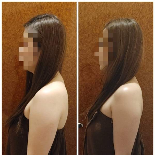 次世代キャビ[脂肪破壊ワボーン]と[脂肪燃焼インキュア]を使用した痩身エステが魅力|ame ホテル日航福岡店