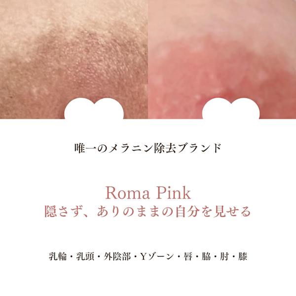 デリケートなお悩みを解決！メラニン除去の新施術「ローマピンク」沖縄上陸！　宜野湾普天間サロン|蘭花Beauty