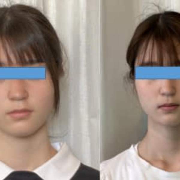 【初回10名様限定】★90分コ-ス◎歪みを整え小顔・美姿勢に◎小顔＋ヘッド＋全身矯正￥6980|やえざきカイロプラクティック