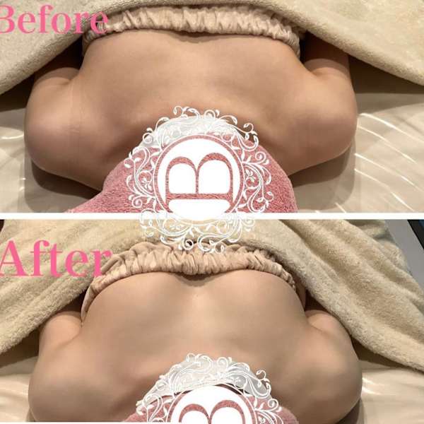 バストラインを整えたい|バストアップ・パンプアップ専門 ミラクルバスト 津田沼本店