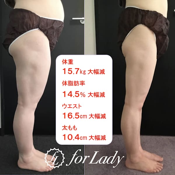 10万人が体験した美脚ケア＆セルライト撃退エステ|フォーレディ前橋店