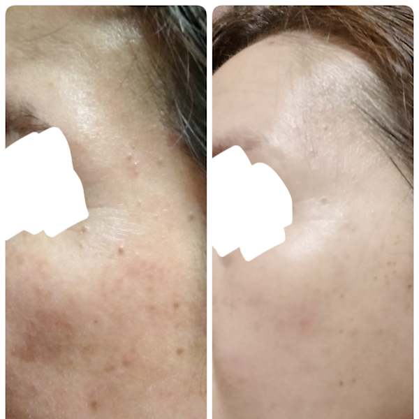 オーダーメードエステティック|Madame VISAGE