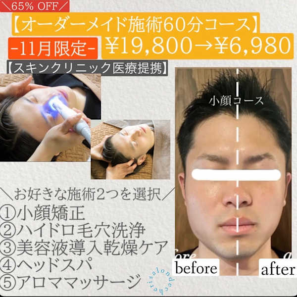 No.2【メンズ小顔矯正リラクフェイシャル】筋膜リリース首肩こりリンパ整体☆|メンズ専門 salon de cheri