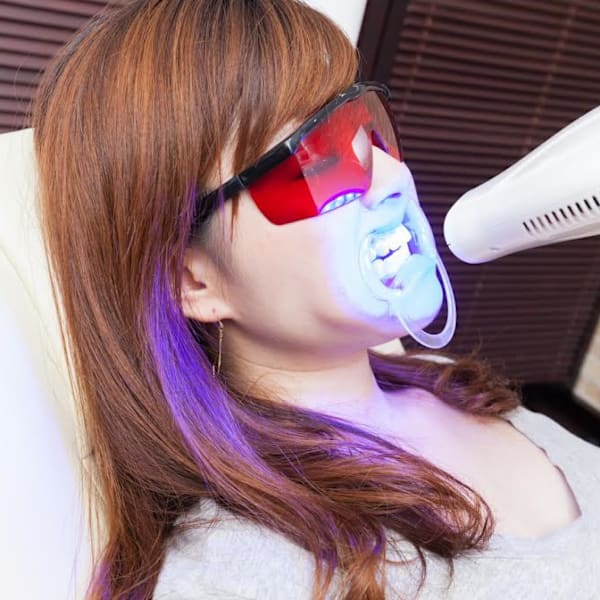 【初回お試し1回￥2500～】まずは一度ご体験を！セルフホワイトニングで、笑顔で輝く白い歯へ♪|おうちサロン しゅろ