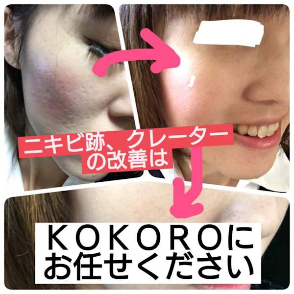 新規メンズの皆様 最大20%引き|BeautyサロンKOKORO