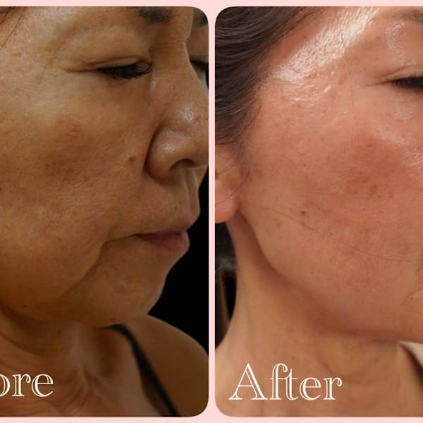 湘南NO,1 肌改善サロンはQueen|トータルビューティサロン Queen茅ヶ崎店