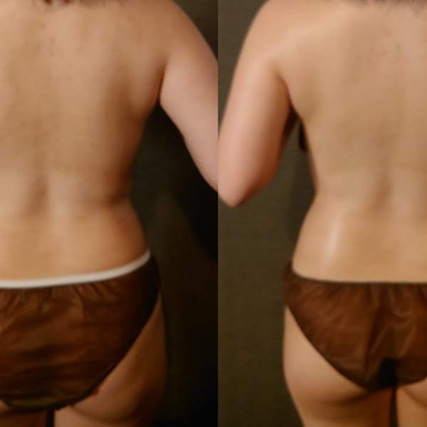 たった1回でも魅力的な魅せボディへ|ame ホテル日航福岡店