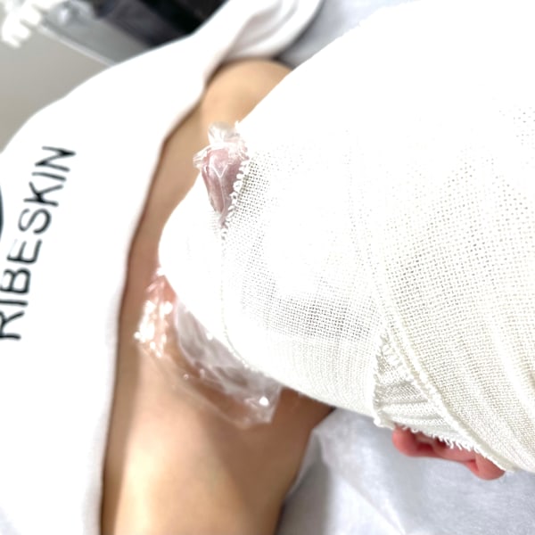 毛穴・くすみ・たるみに◎炭酸×再生カーボキシーケア|BeautySalonMuse