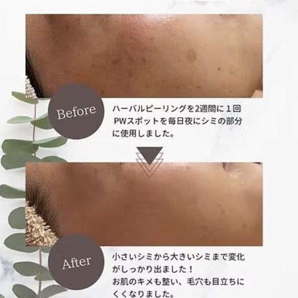 ハイブリッド型 ハーブピーリングエステティック|Madame VISAGE