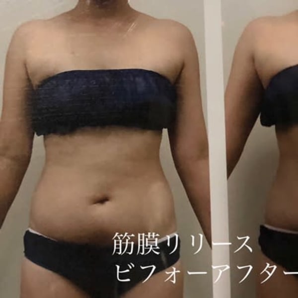 筋膜リリース|lapaisible