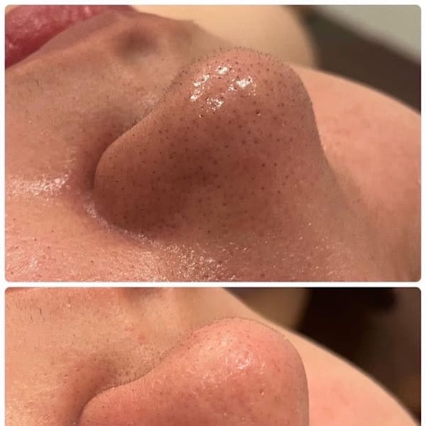 男性の方大歓迎◎脱毛・フェイシャル・毛穴ケア・痩身など、男性のお悩みに特化したメニューをご用意♪|TOTAL CLEAR