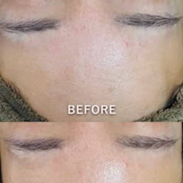 毛穴レス&透明感UP☆写真映えする素肌へ...人気のメニュー集♪|Luke Beautysalon