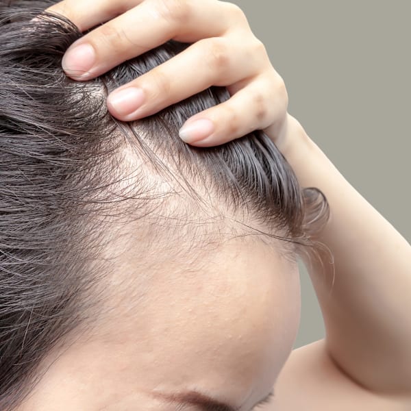 最近、生え際が気になり始めた...枕元の抜け毛が怖い...メンズ/縮毛矯正/白髪/髪質改善|Happis