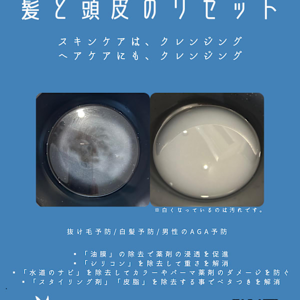 30代からの「疲れた頭皮」に寄り添う、1番人気のヘッドスパで健やかに！|SEAGULLIII