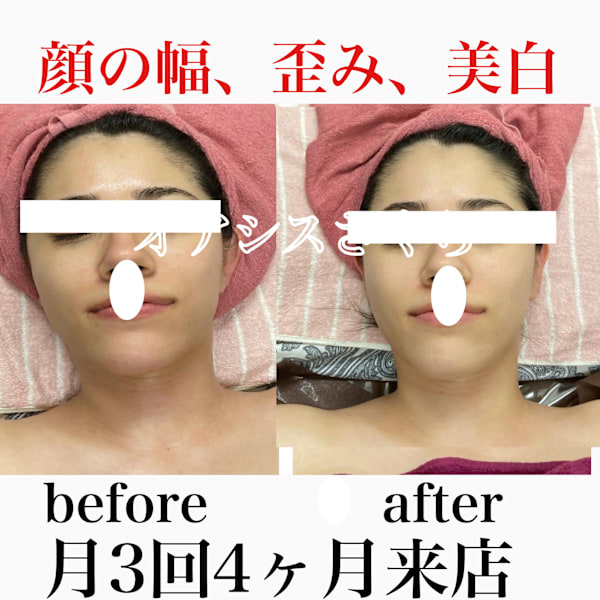 美禅筋骨×小顔コルギ|オアシス・さくら