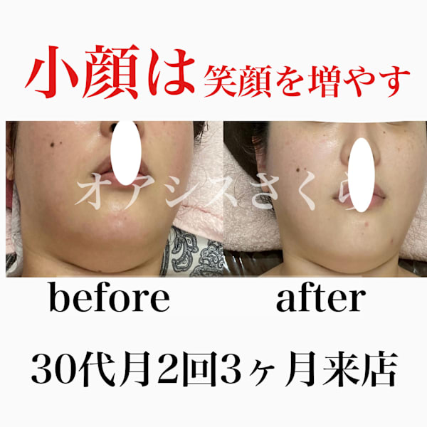 美禅筋骨×小顔コルギ|オアシス・さくら