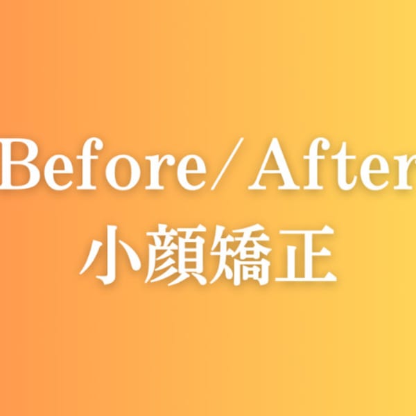 Before/After小顔矯正|小顔矯正/美容整体 LuLu beauty labo【ルルラボ】