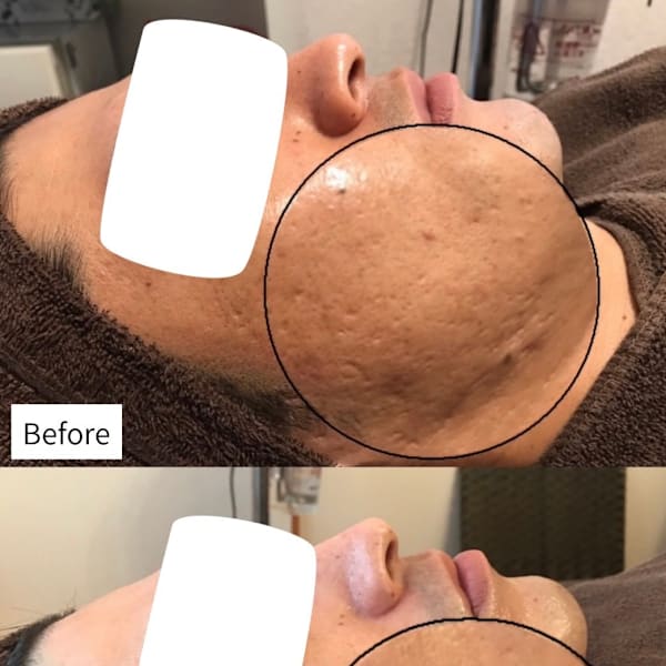 メンズたるみフェイシャル|肌質改善&デトックスボディ専門店CELL-セル-