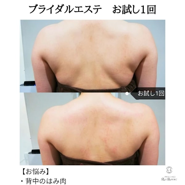 ブライダルエステで最高に輝く1日に|弘前エステサロン　RiとBiのたまご