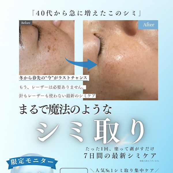 40代から急に増えたシミ、「もう取れないかも」と 諦めてしまっている方へ。|プリンセスエステティックサロン Couronne