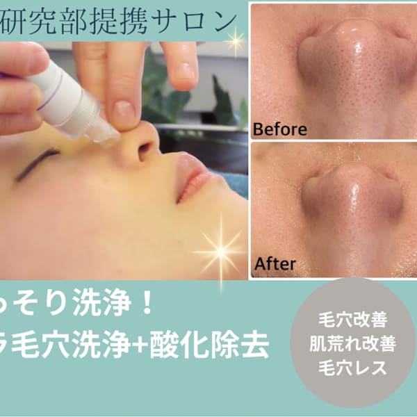 人気メニュー♪♪【毛穴ごっそり洗浄】ハイドラシャイン毛穴洗浄+極上ヘッドスパ50分|トータル美還元サロン mindエステ仙台店