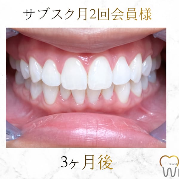 【有名メディア掲載】完全個室で気にせずにセルフホワイトニング♪感動口コミ多数/高評価の信頼◎|Whi-Ya(ホワイヤ)セルフホワイトニングDBS神楽坂