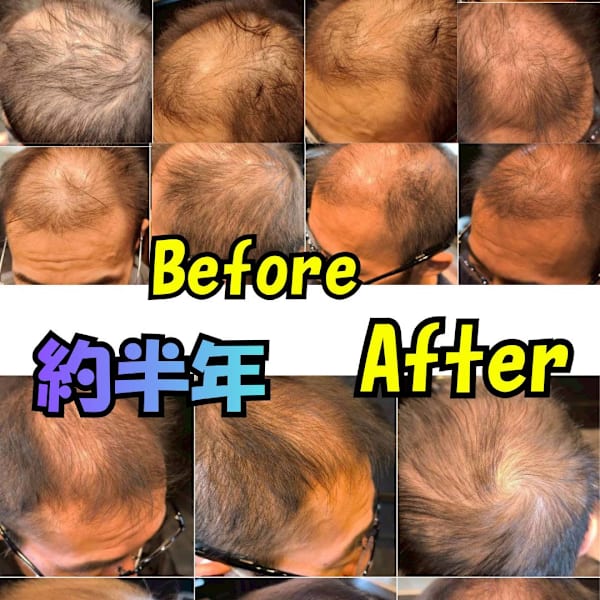 本気で育毛＆発毛ケアの研究に力を入れている、全理連ヘアカウンセラーが常駐するヘアサロン。|The BARBER High Grooming
