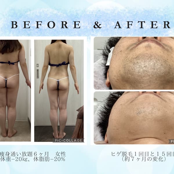 たくさんのお客様が効果を実感！|【脱毛・本格ダイエット・痩身】リオンズ柏駅前店