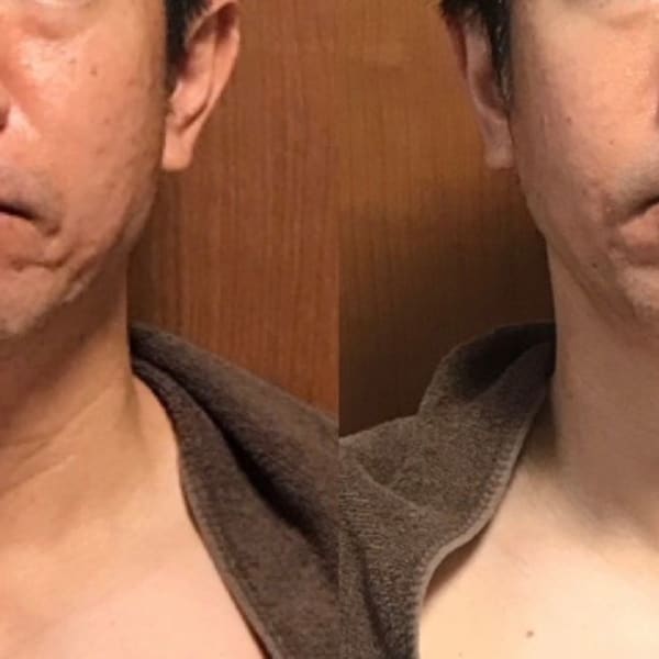 メンズたるみフェイシャル|肌質改善&デトックスボディ専門店CELL-セル-