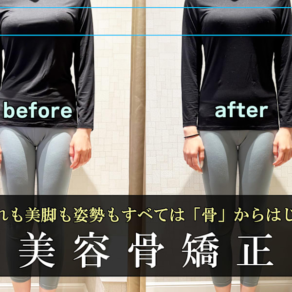 美容骨矯正で骨格から根本改善!1回で歪み・姿勢・たるみを整え、本来の美しさを呼び覚ます。|SALON DE S AOYAMA(サロン・ド・エス アオヤマ)