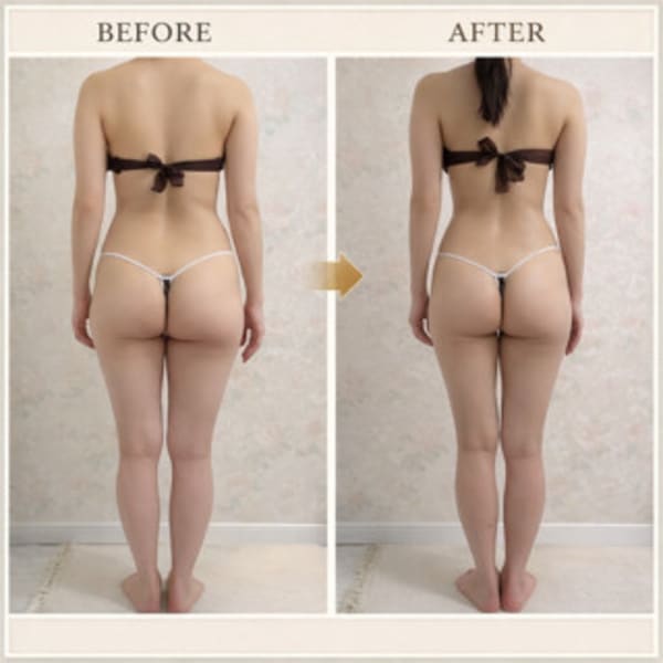 オーダーメイド痩身¥15.990→¥9.990-(custom-made slimming tre)|SALON DE JEWEL