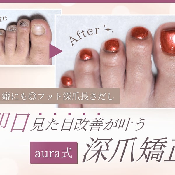 フットネイル深爪矯正(長さだしスカルプ)もご案内可能です☆フットバス込み♪【赤羽駅徒歩3分】|aura nail factory